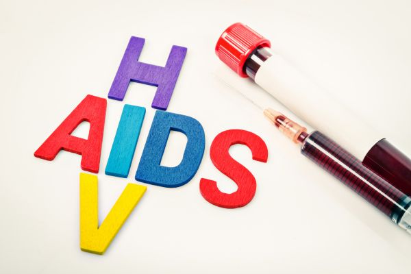 What is HIV/AIDS causes, symptoms, treatment